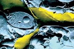Micrografie-di-sinapsi-1